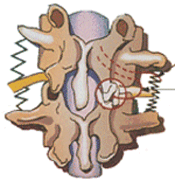 Illustratie over hoe subluxatie het zenuwstelsel verstoord. Wat is een subluxatie? 
